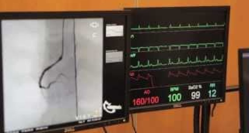 Cardiac Catheterisation Part 1 - Left Coronary